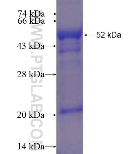 NEU1 fusion protein Ag13542 SDS-PAGE NEU1 fusion protein Ag13542 SDS-PAGE