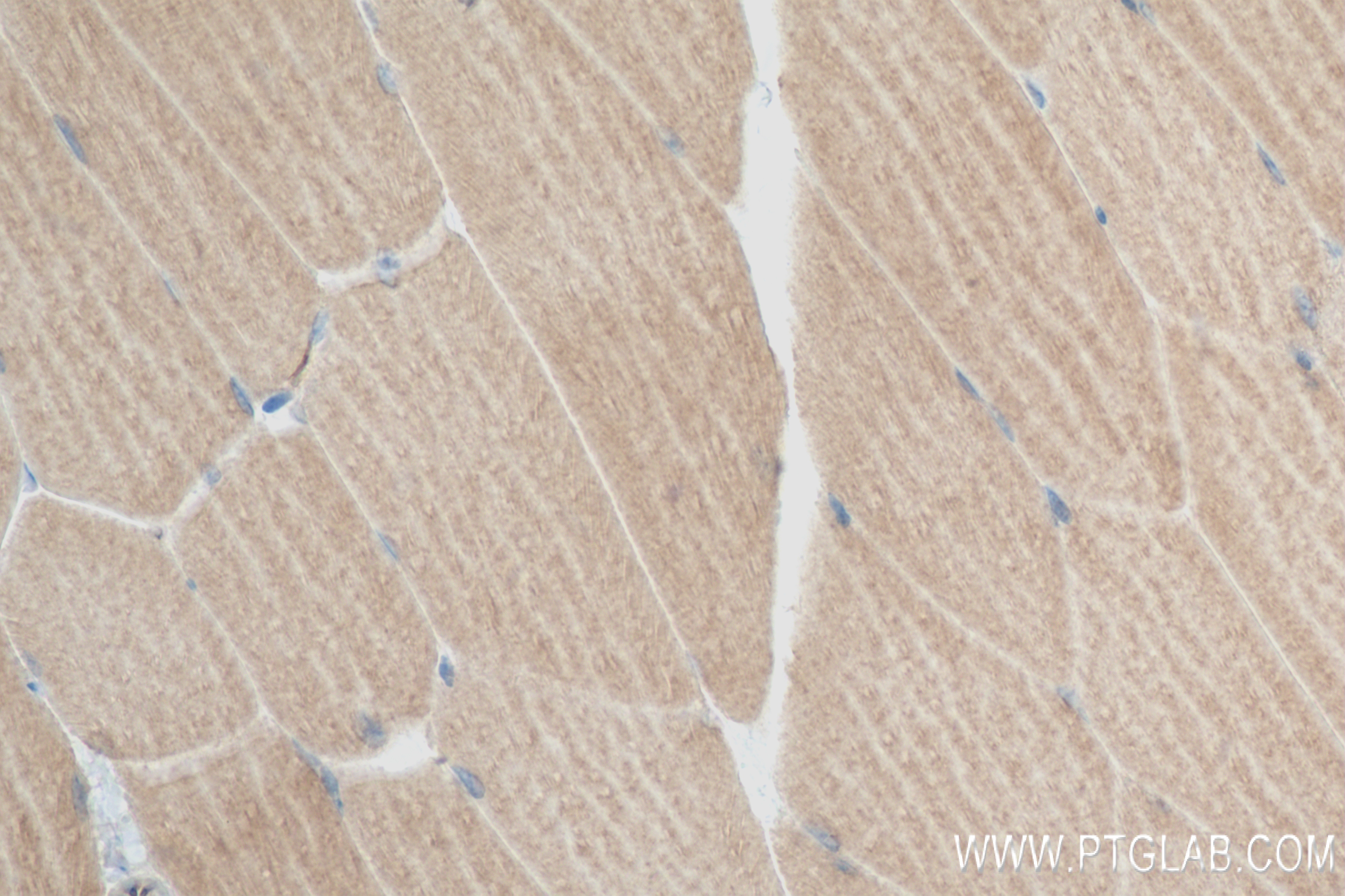 IHC staining of mouse skeletal muscle using 83934-1-RR