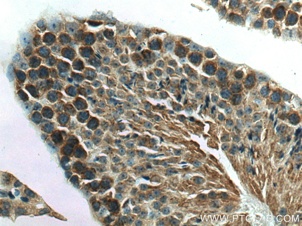 IHC staining of mouse testis using 27879-1-AP