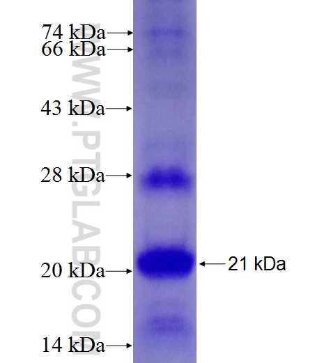 NEU3 fusion protein Ag27272 SDS-PAGE