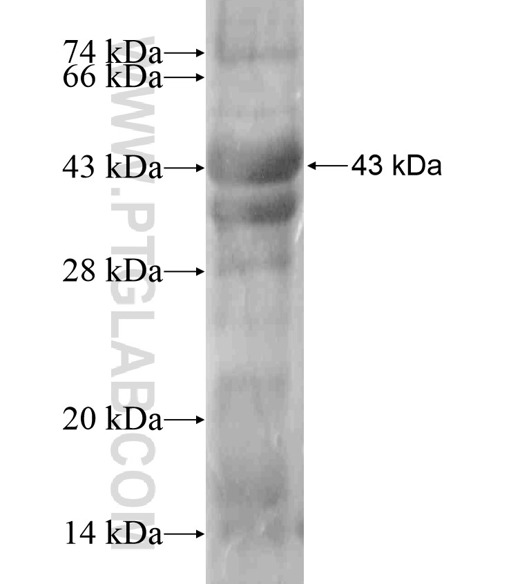 NEU4 fusion protein Ag18049 SDS-PAGE NEU4 fusion protein Ag18049 SDS-PAGE