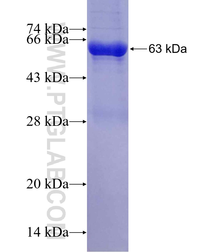 NEU4 fusion protein Ag3657 SDS-PAGE