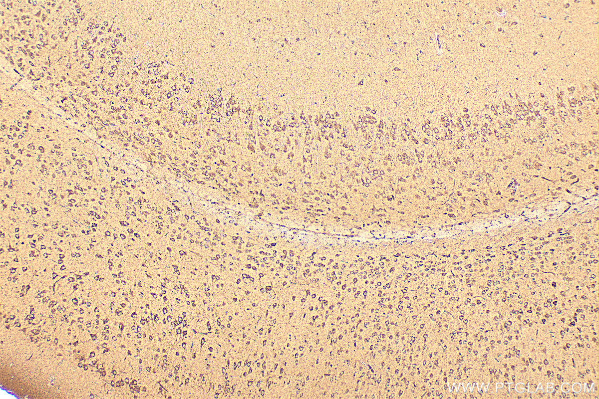 IHC staining of mouse brain using 18898-1-AP