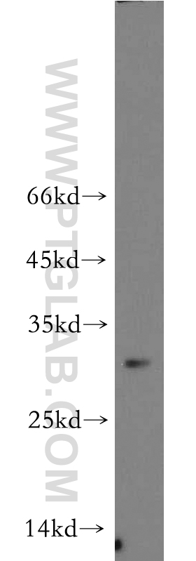 WB analysis of HL-60 using 21263-1-AP