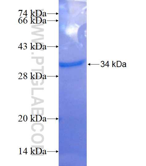NEURL2 fusion protein Ag15874 SDS-PAGE NEURL2 fusion protein Ag15874 SDS-PAGE