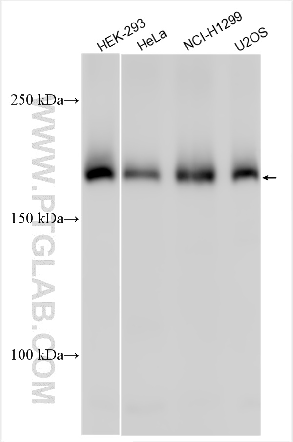 WB analysis using 55345-1-AP