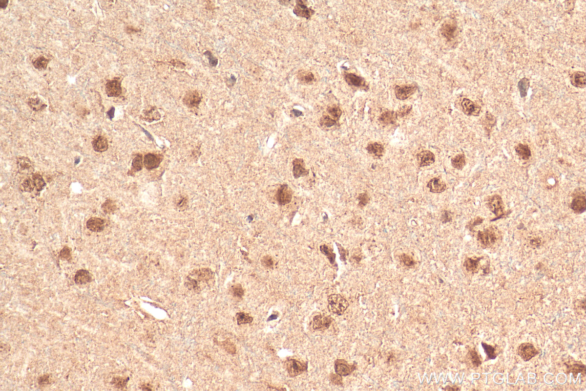 IHC staining of rat brain using 12081-1-AP