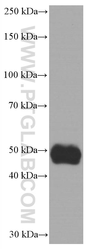 WB analysis of Y79 using 66691-1-Ig