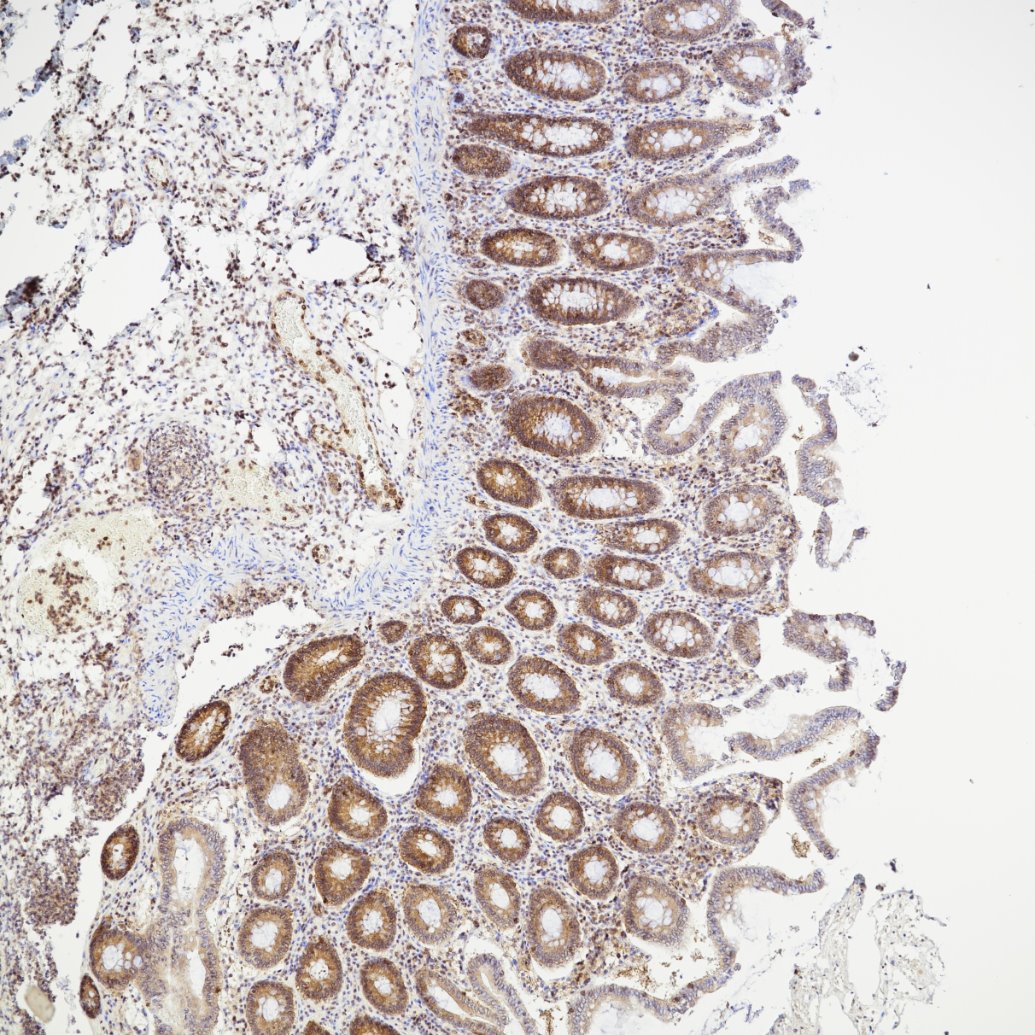 IHC staining of human colon using 80979-1-RR