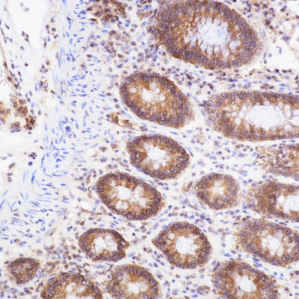 IHC staining of human colon using 80979-1-RR