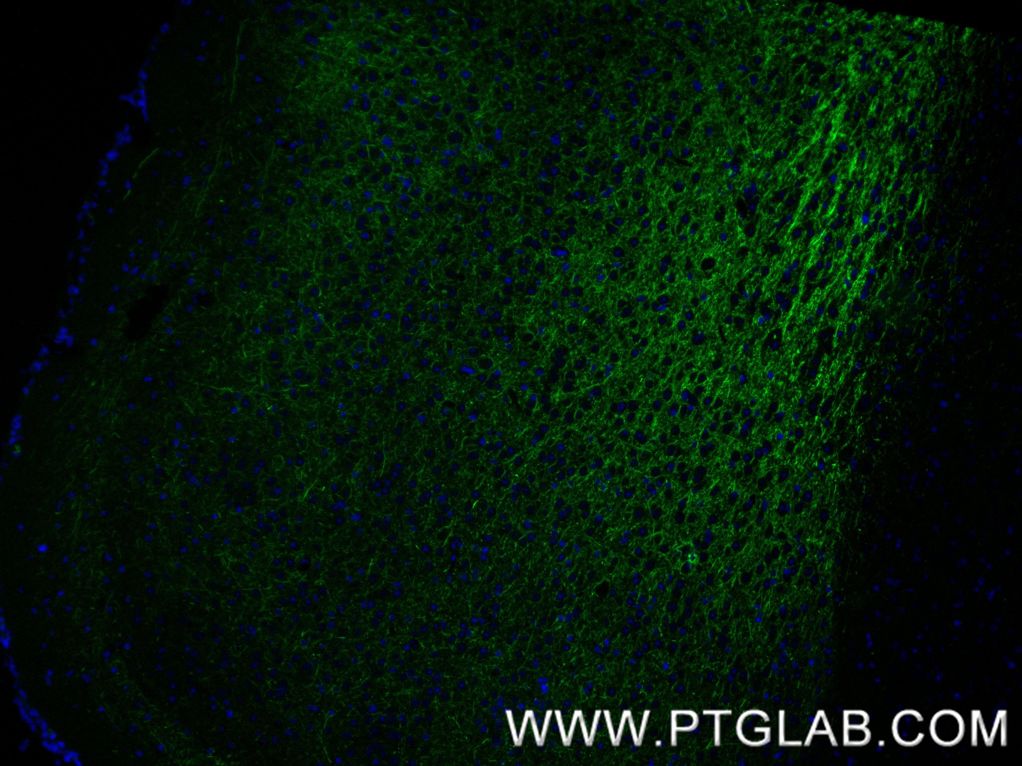 IF Staining of mouse brain using 87694-1-RR (same clone as 87694-1-PBS)