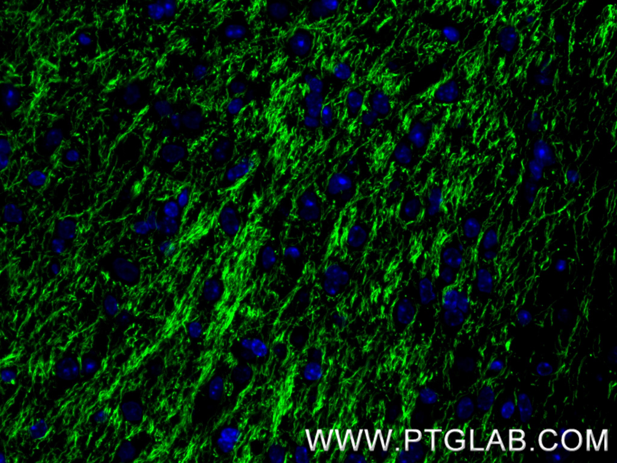 IF Staining of mouse brain using 87694-1-RR (same clone as 87694-1-PBS)
