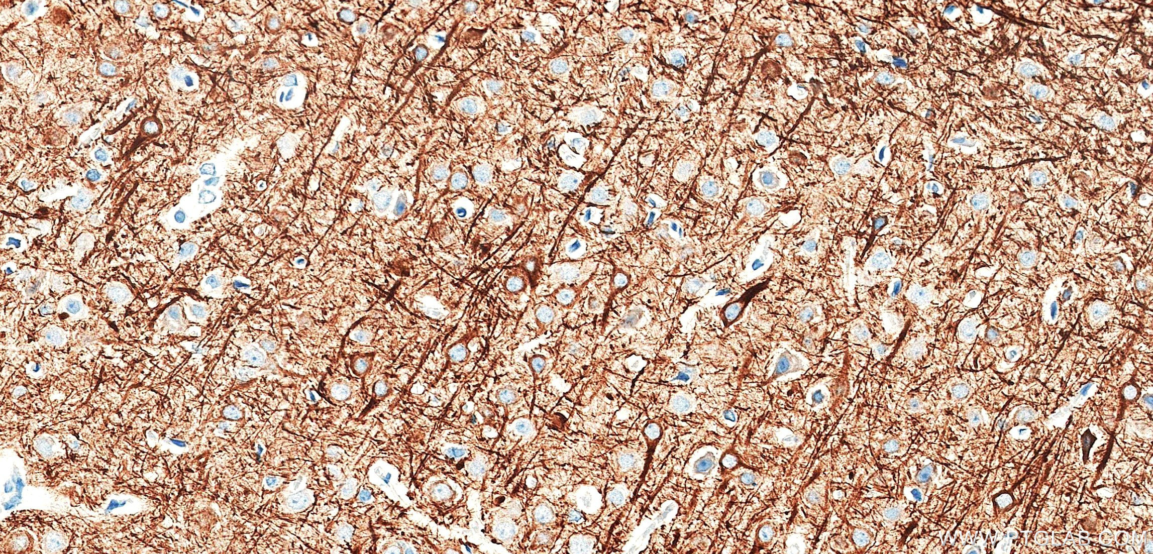 IHC staining of rat brain using 87694-1-RR (same clone as 87694-1-PBS)