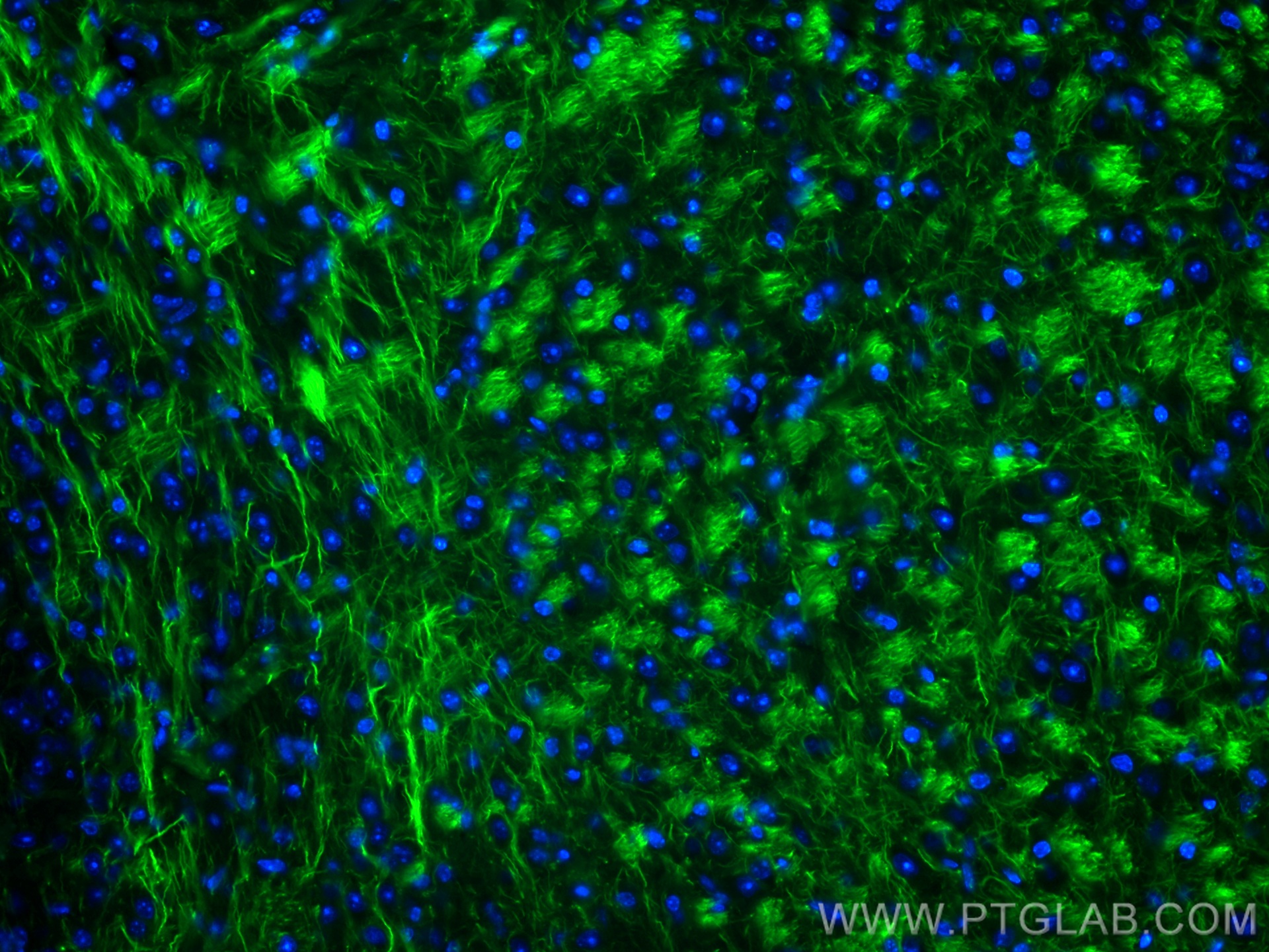 IF Staining of mouse brain using CL488-60189