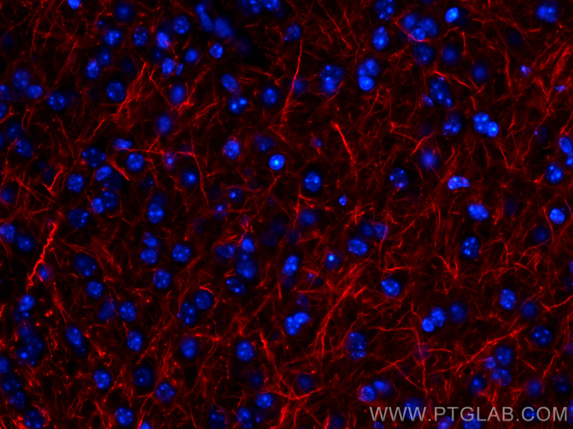 IF Staining of mouse brain using CL594-60189