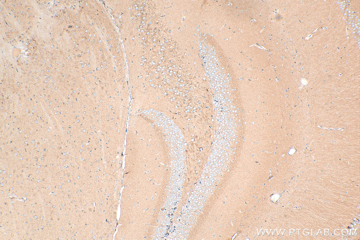 IHC staining of mouse brain using 21686-1-AP