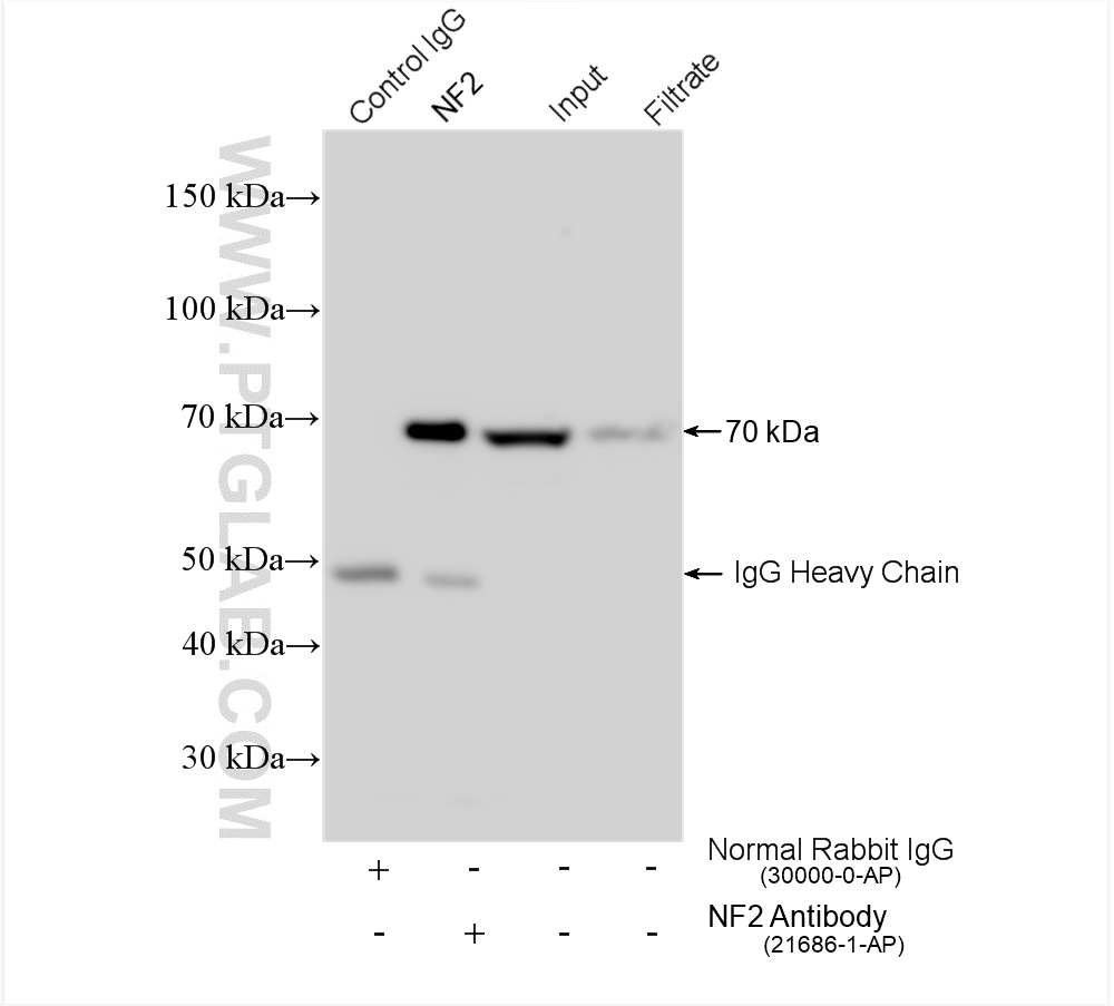 IP experiment of HeLa using 21686-1-AP