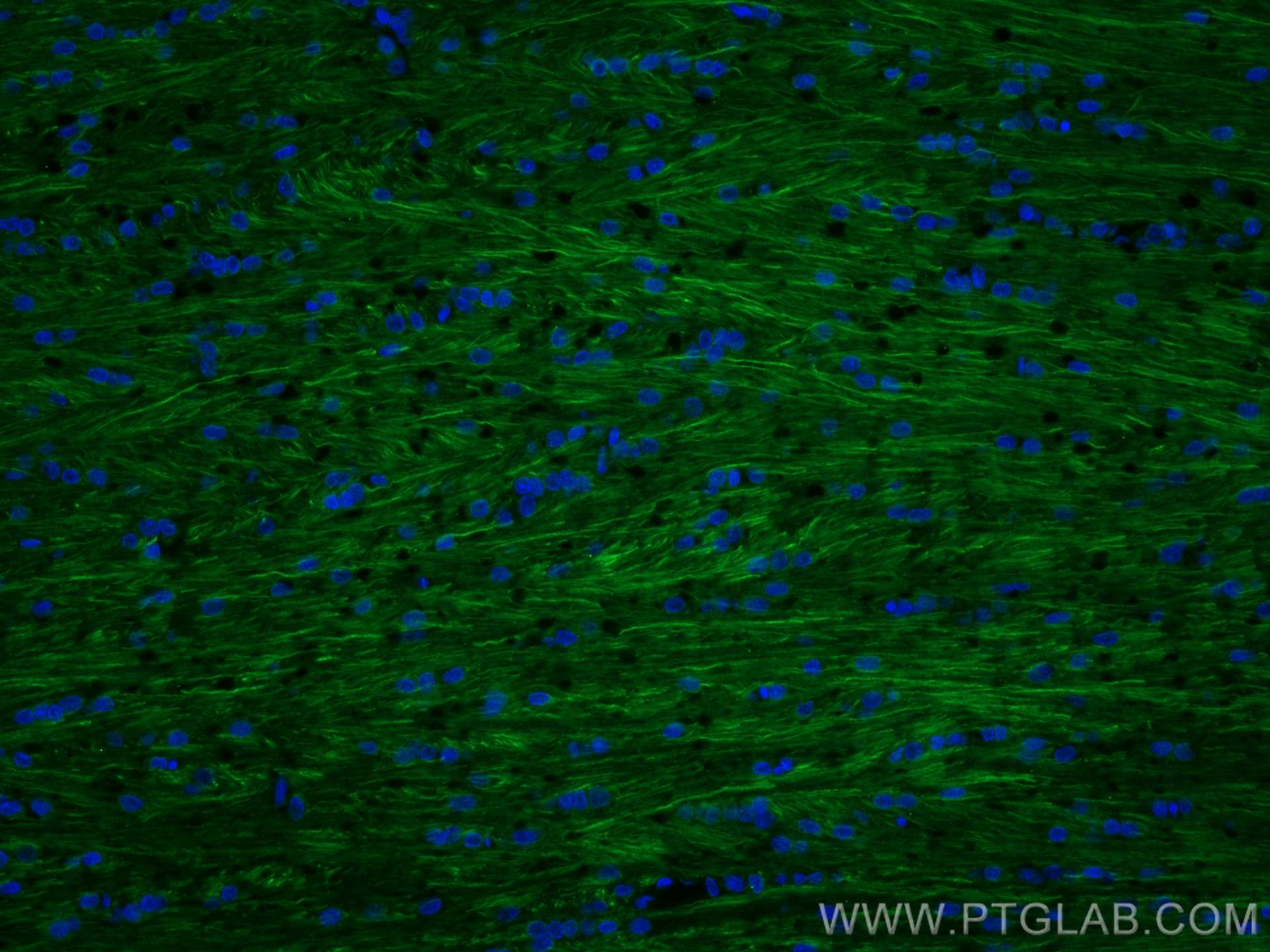 IF Staining of rat brain using 60331-1-Ig (same clone as 60331-1-PBS)