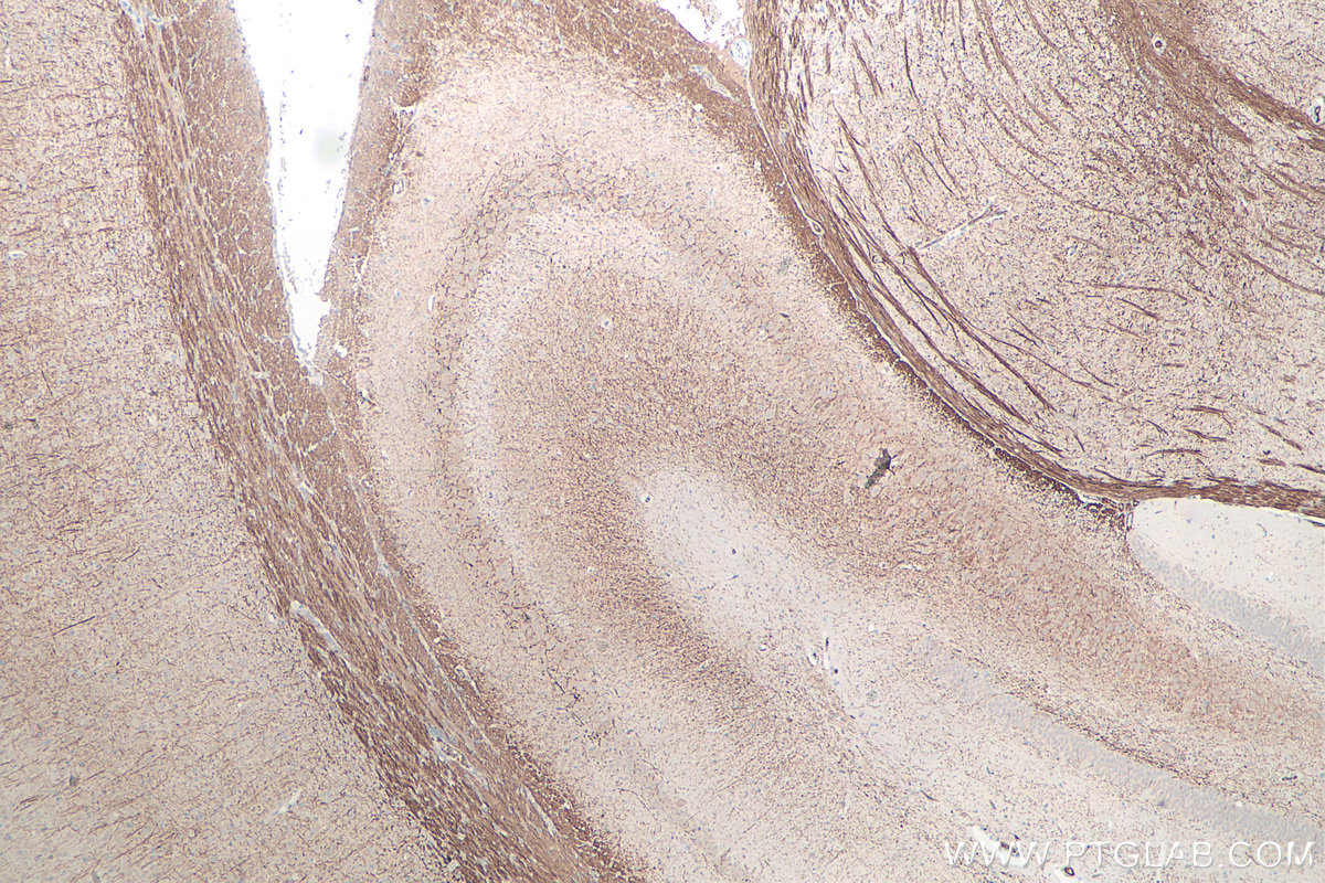 IHC staining of rat brain using 60331-1-Ig