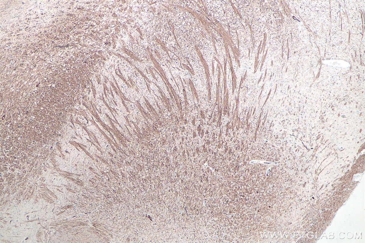 IHC staining of rat brain using 60331-1-Ig IHC staining of rat brain using 60331-1-Ig