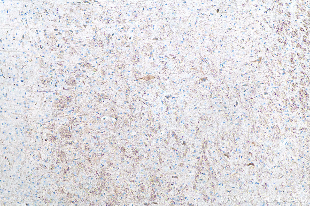 IHC staining of mouse cerebellum using 60331-1-Ig IHC staining of mouse cerebellum using 60331-1-Ig