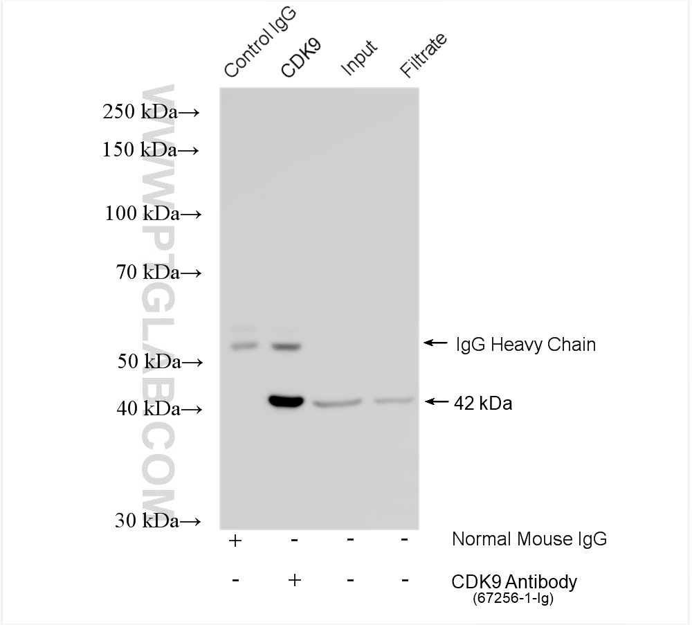 IP experiment of HeLa using 67685-1-Ig (same clone as 67685-1-PBS)