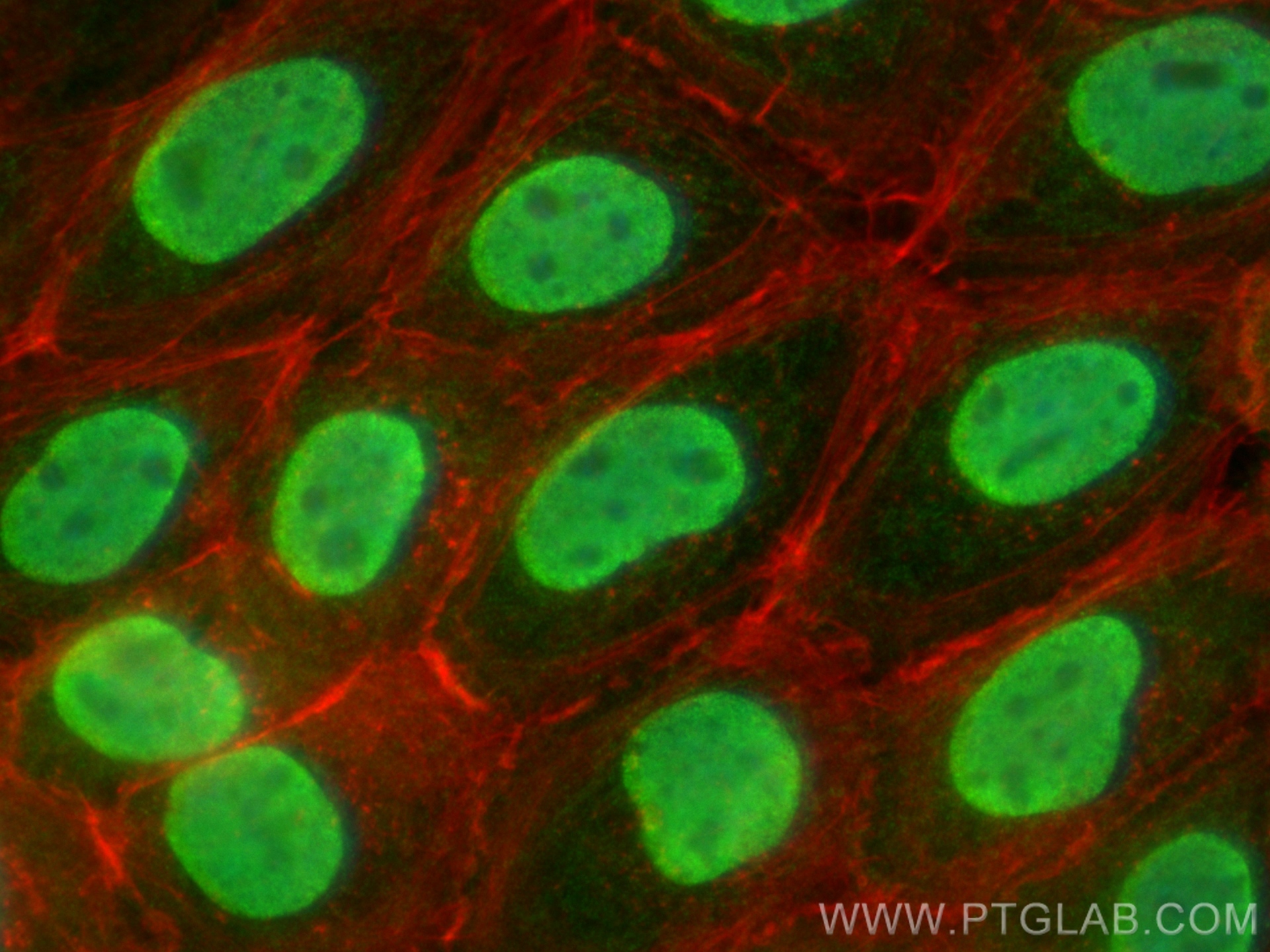 Immunofluorescent analysis of (4% PFA) fixed A431 cells using NF90/ILF3 antibody (19887-1-AP) at dilution of 1:400 and CoraLite®488-Conjugated Goat Anti-Rabbit IgG(H+L) (<a class='green' href='/productredirect?CatalogNo=SA00013-2' target='_blank'>SA00013-2</a>), CL594-phalloidin (red). IF Staining of A431 using 19887-1-AP