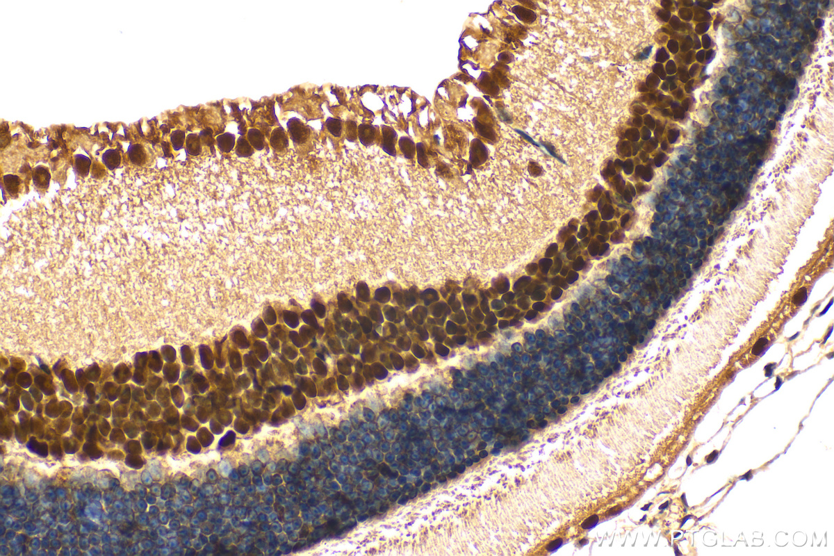 IHC staining of mouse eye using 68213-1-Ig (same clone as 68213-1-PBS)
