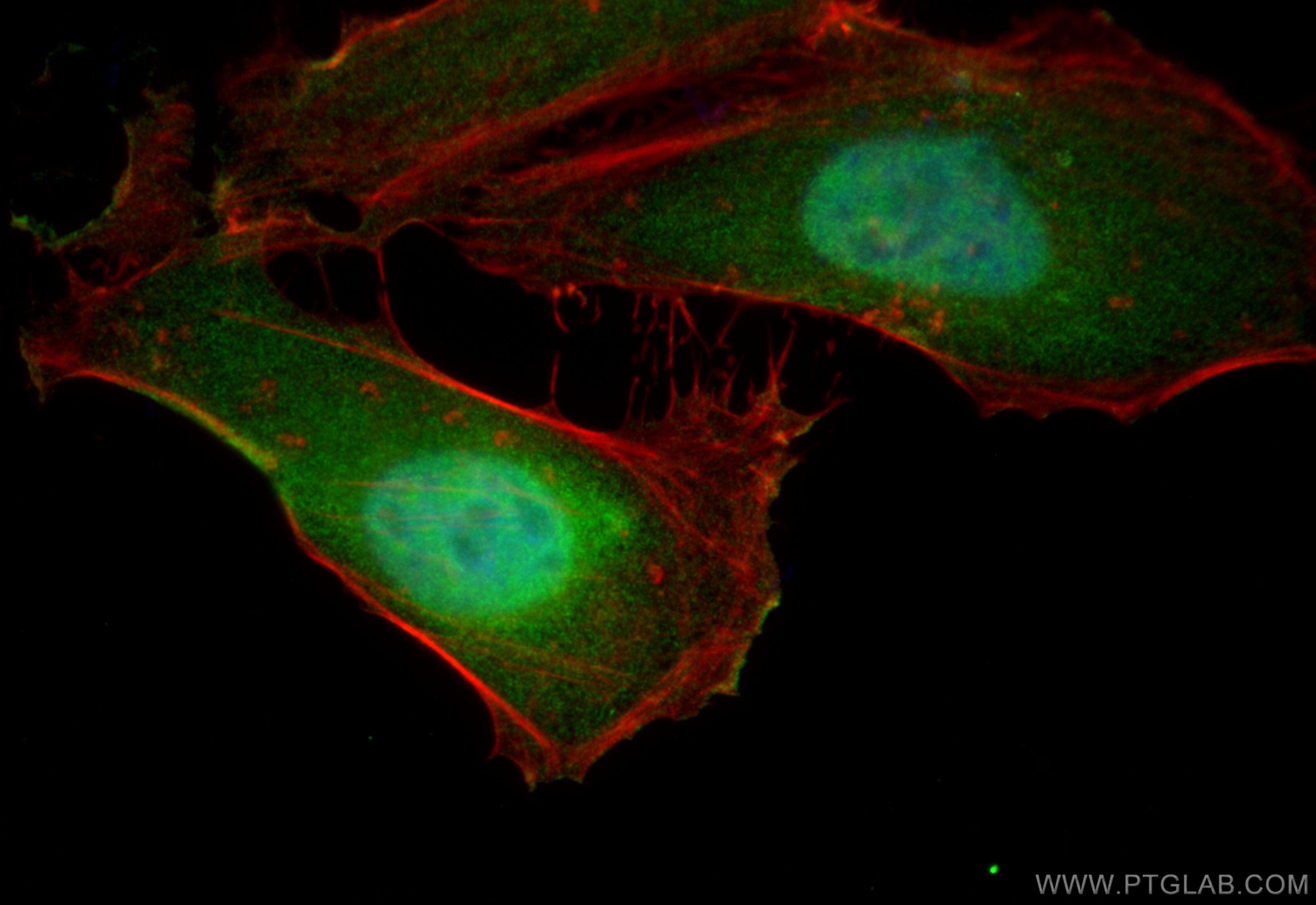 IF Staining of HeLa using 11667-1-AP