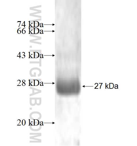 NFATC2IP fusion protein Ag2217 SDS-PAGE