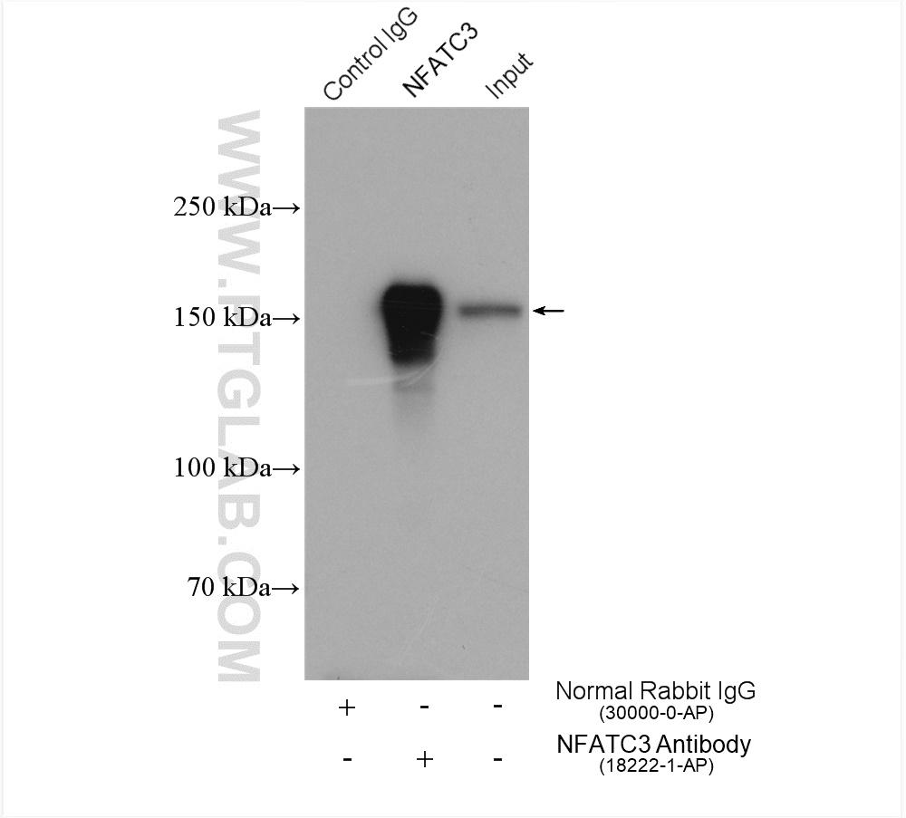 IP experiment of K-562 using 18222-1-AP