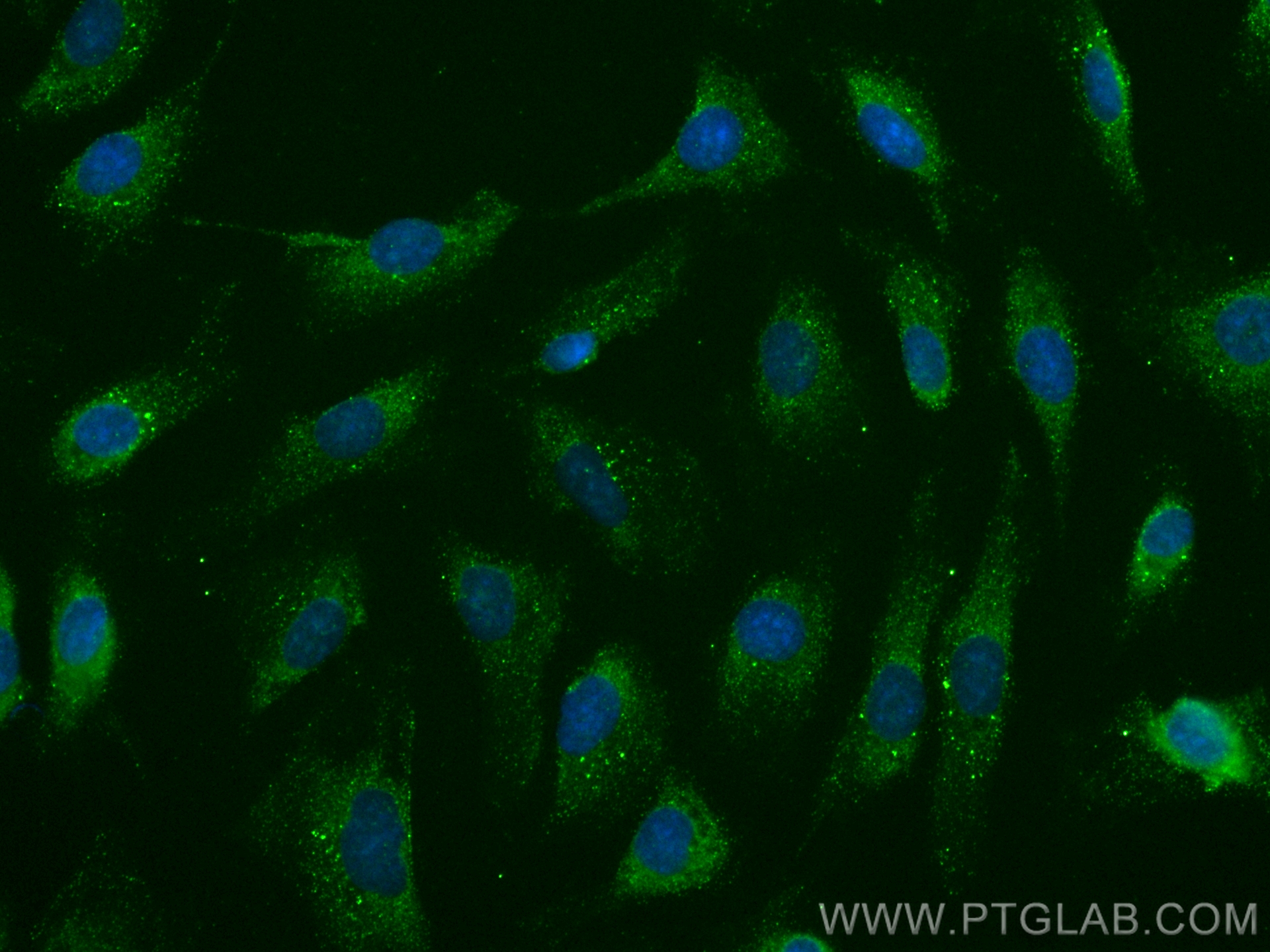 IF Staining of SKOV-3 using 66924-1-Ig (same clone as 66924-1-PBS)