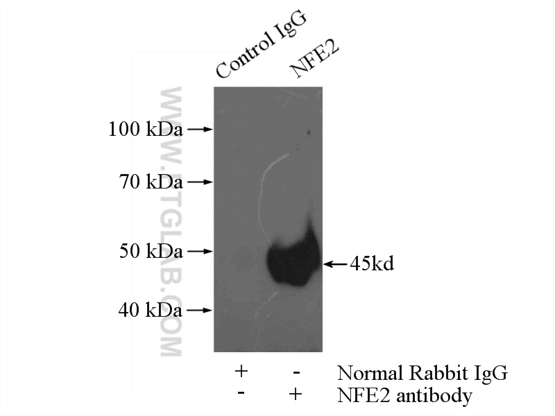 IP experiment of K-562 using 11089-1-AP