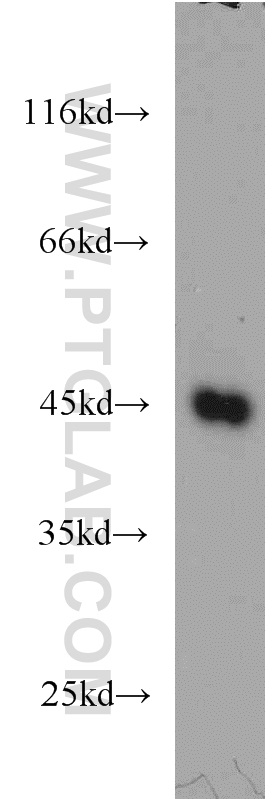 WB analysis of K-562 using 11089-1-AP