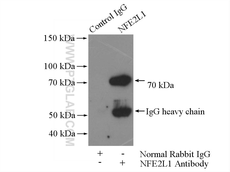 IP experiment of mouse skeletal muscle using 12936-1-AP