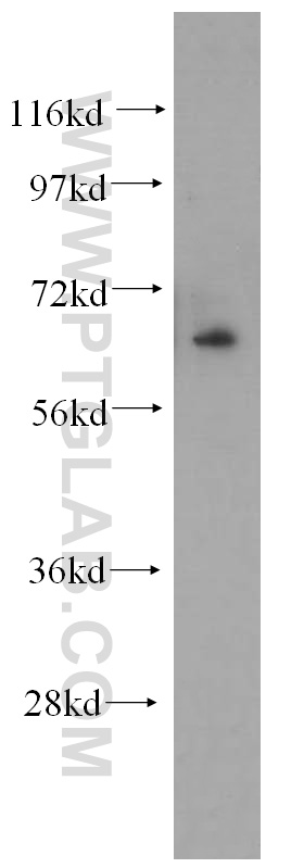 WB analysis of mouse skeletal muscle using 12936-1-AP