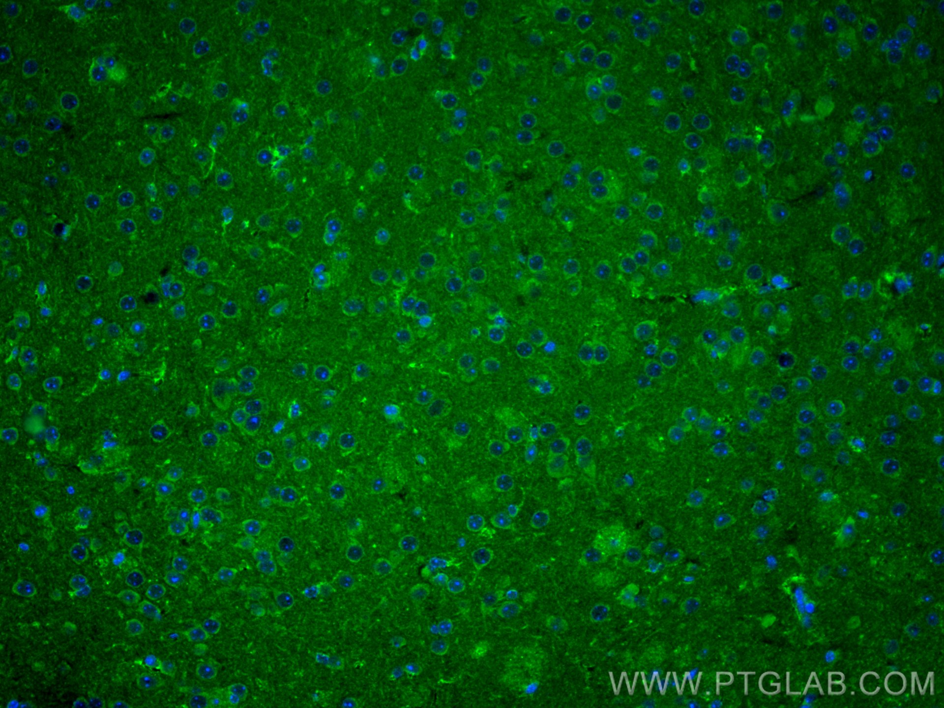 IF Staining of mouse brain using 16396-1-AP