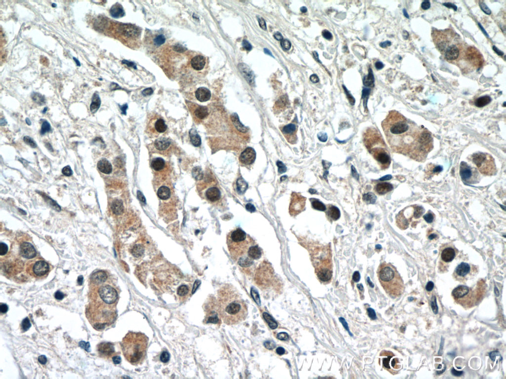 NRF2, NFE2L2 Polyclonal antibody