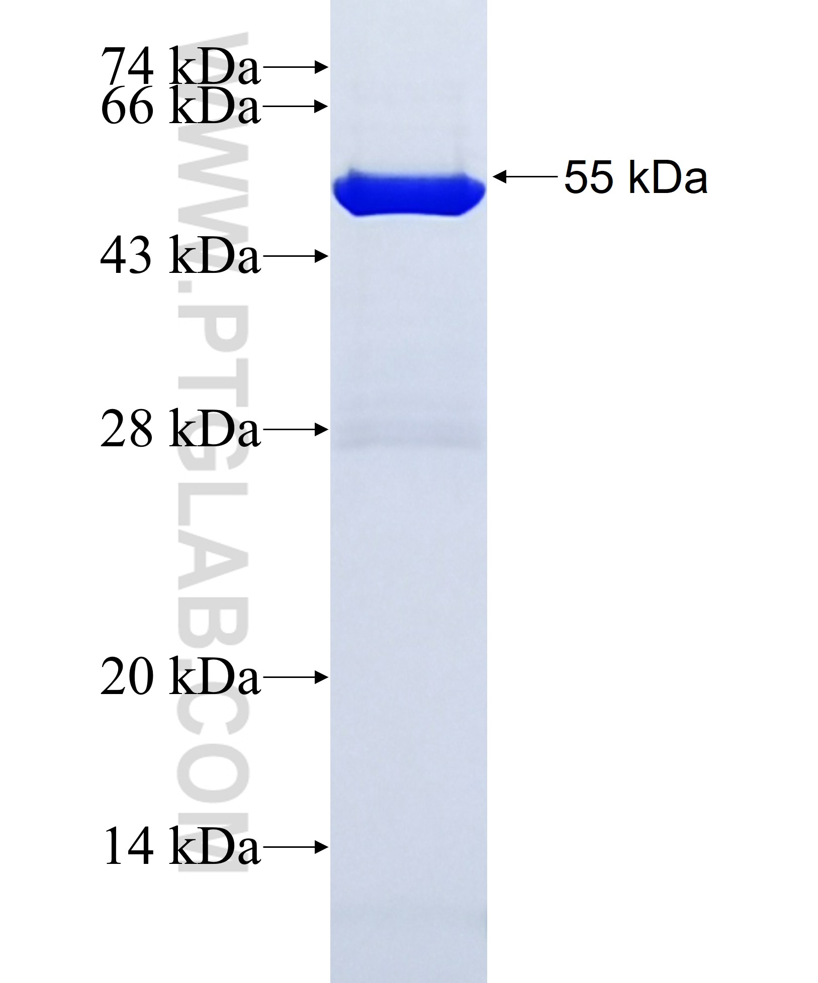 NFE2L3 fusion protein Ag29417 SDS-PAGE NFE2L3 fusion protein Ag29417 SDS-PAGE