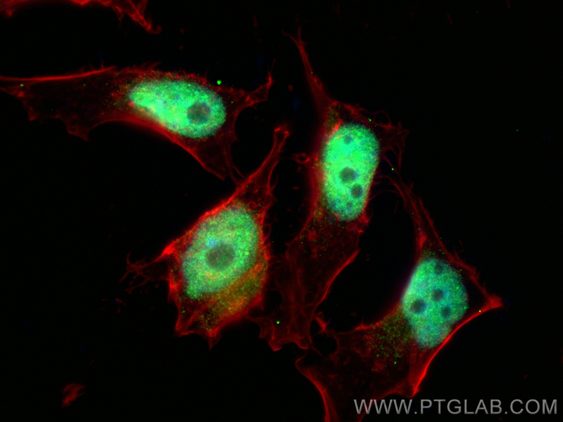 IF Staining of HeLa using 29898-1-AP