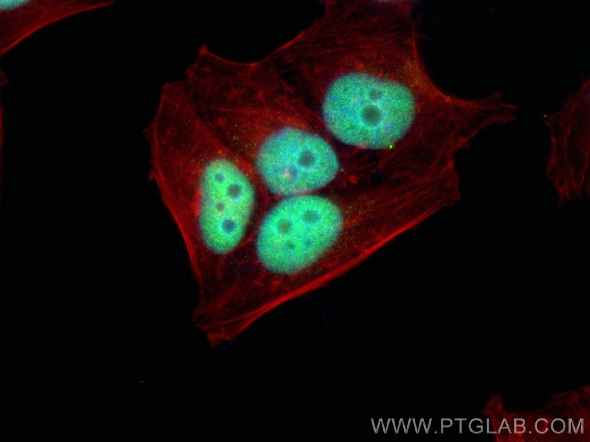 IF Staining of HepG2 using 29898-1-AP