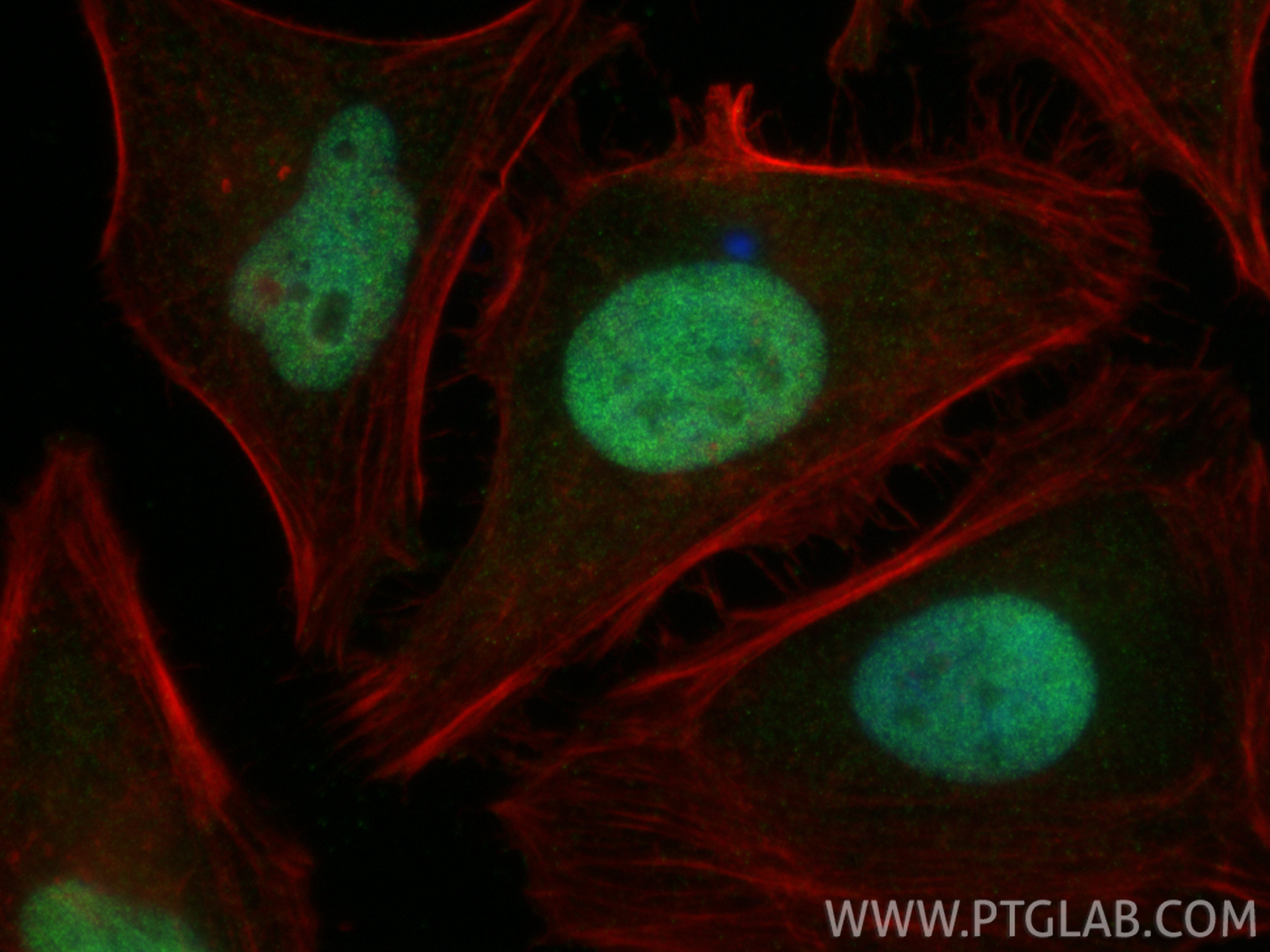 IF Staining of HeLa using 29898-1-AP IF Staining of HeLa using 29898-1-AP