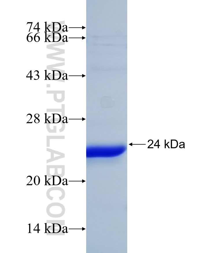 NFIB fusion protein Ag31991 SDS-PAGE NFIB fusion protein Ag31991 SDS-PAGE