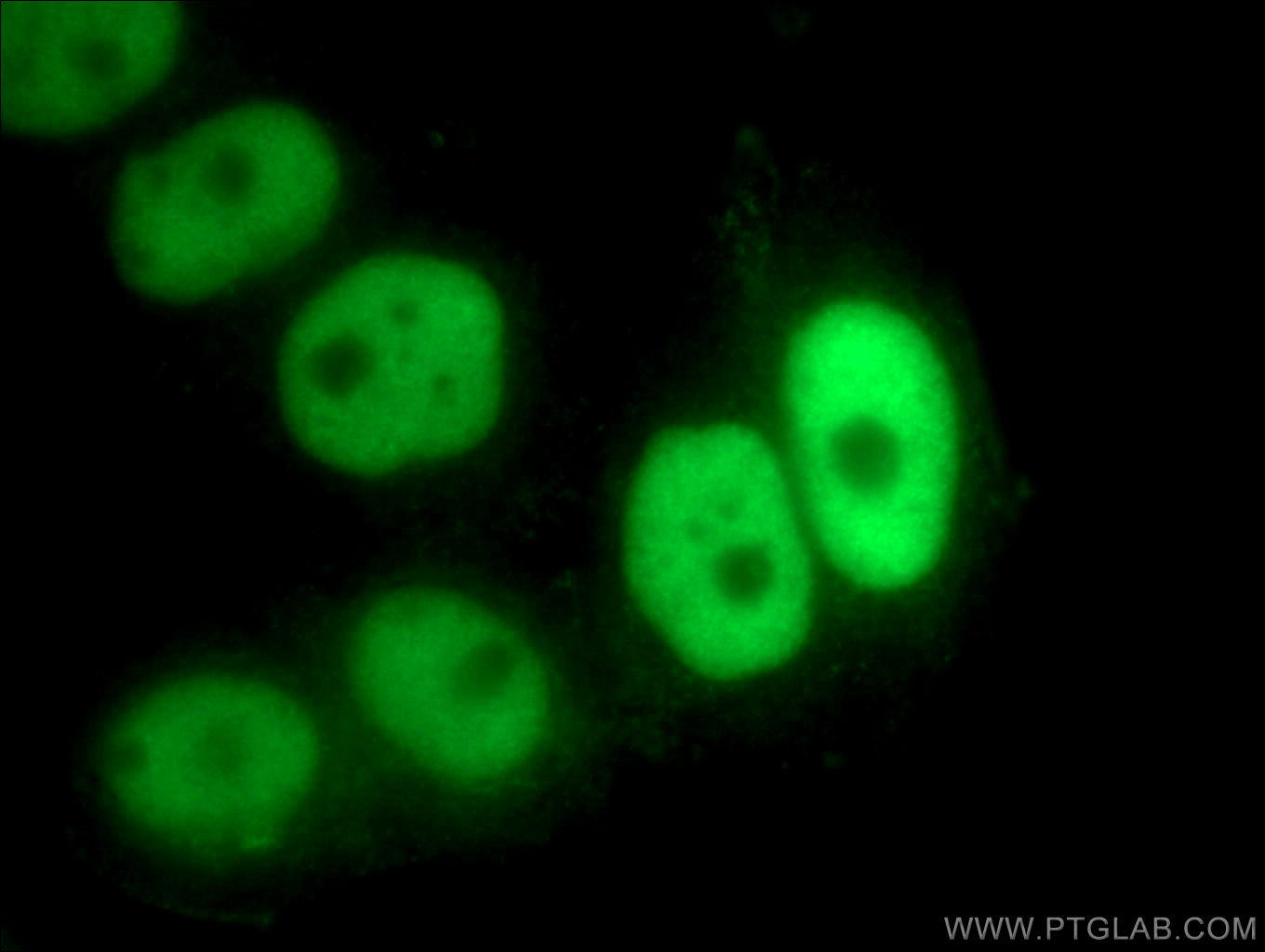 IF Staining of PC-3 using 16399-1-AP