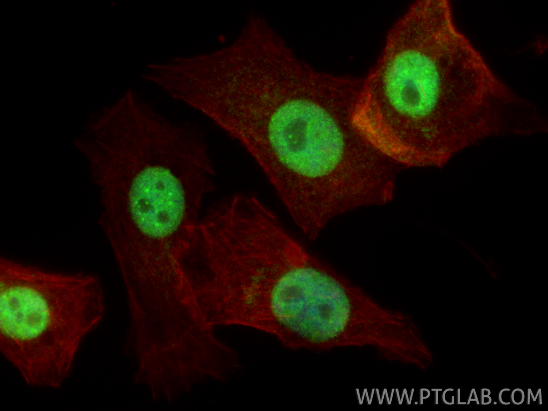 IF Staining of PC-3 using 16399-1-AP IF Staining of PC-3 using 16399-1-AP