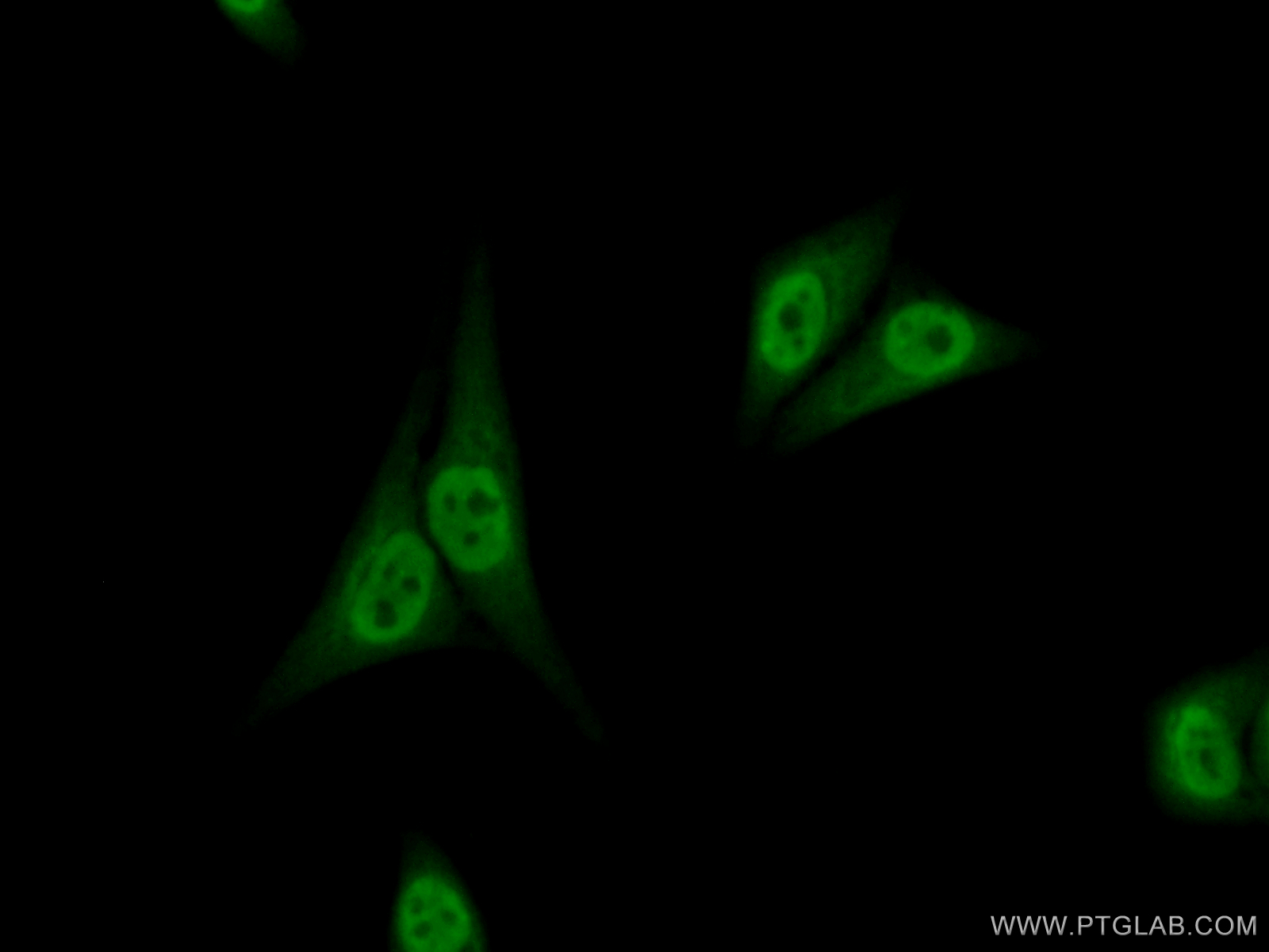 IF Staining of HepG2 using 11773-1-AP