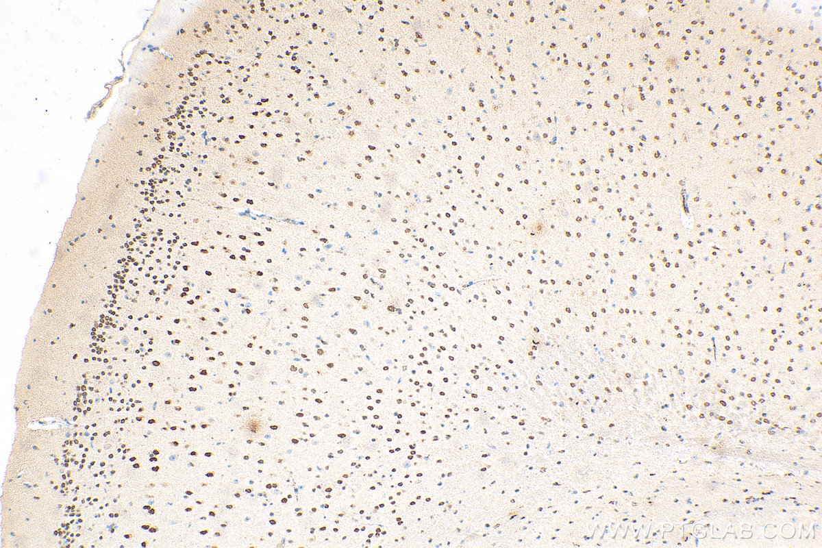 IHC staining of mouse brain using 67983-1-Ig (same clone as 67983-1-PBS)