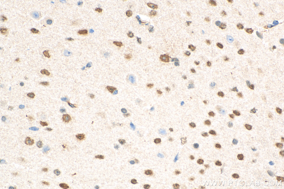 IHC staining of mouse brain using 67983-1-Ig (same clone as 67983-1-PBS)