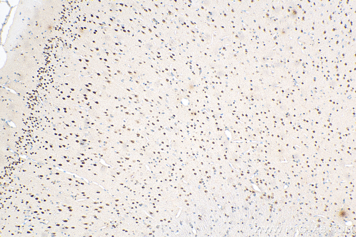 IHC staining of rat brain using 67983-1-Ig (same clone as 67983-1-PBS)