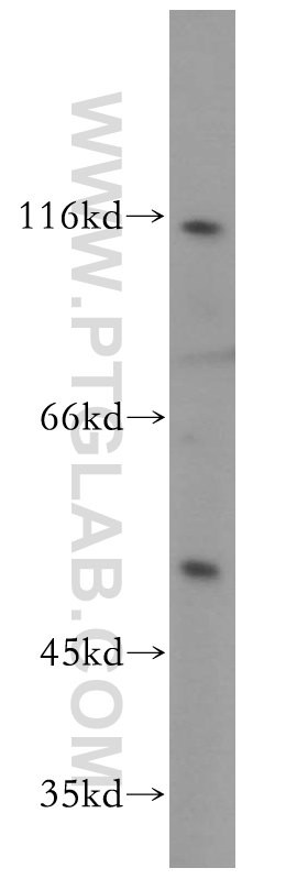 WB analysis of A431 using 15506-1-AP